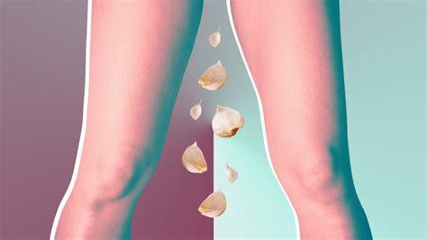 Why Putting Garlic In Your Vagina To Treat Yeast Infections Is A Really Bad Idea According To
