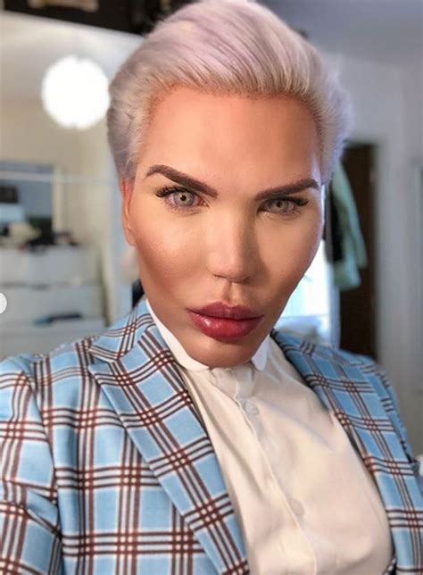 What Did Celebrity Big Brothers Rodrigo Alves Look Like Before Surgery