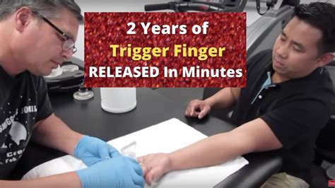 2 years of trigger finger released in minutes real results youtube