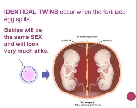 Identical Twins Originate From The Fertilization Of Hiccups Pregnancy