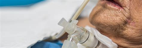 Timely Tracheostomy Use Helped Patients With Coronavirus Duke Health