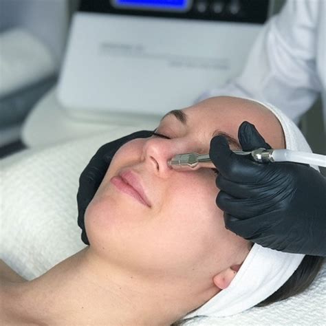 Rejuvenate Your Skin With Microdermabrasion Machine