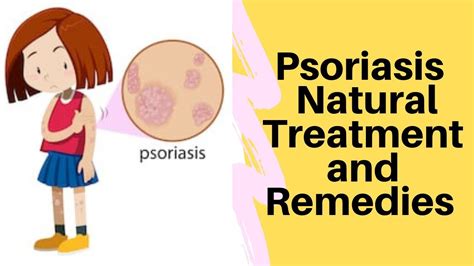 Video Treat Psoriasis With Ayurvedic Treatments By Ayushakti Smita