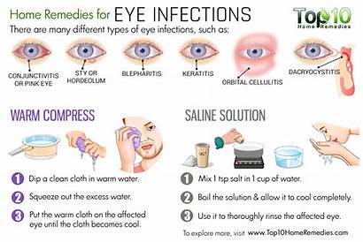Eye Remedies Infections Infection Eyelid Eyes Pain