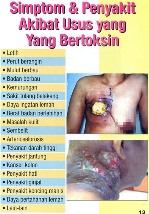 Tiada pengesanan awal dapat dikesan. Sumber Informasi Terkini©: 7/1/13 - 8/1/13