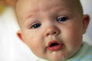 Beberapa cara mengatasi hidung tersumbat pada bayi bisa dilakukan tanpa obat. CARA MELEGAKAN HIDUNG BAYI TERSUMBAT DISEBABKAN SELSEMA