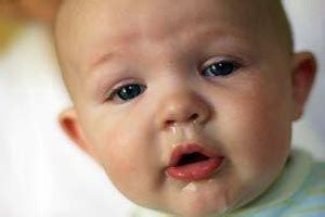 Cara menghilangkan bintik hitam bekas jerawat. CARA MELEGAKAN HIDUNG BAYI TERSUMBAT DISEBABKAN SELSEMA