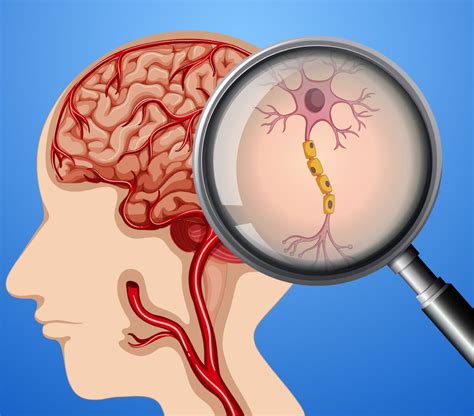Early Symptoms Of Brain Hemorrhage Recognizing The Warning Signs Dr