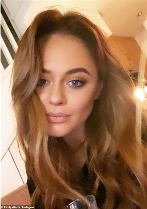 Emily Atack Jokes She Popped On Some Bad Fake Tan To Go And Flirt With