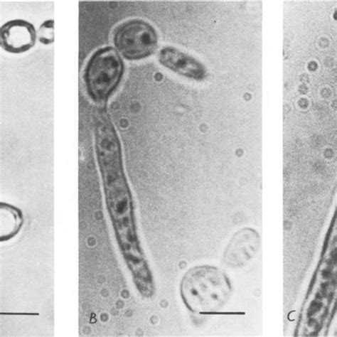 Microscopic Appearance Of Candida Albicans A Germ Tubes Gt At 6 H Download Scientific