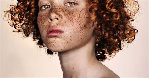 Freckles Brock Elbanks Striking Portraits In Pictures Art And Design The Guardian