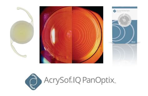 AcrySof IQ Panoptix мультифокальная ИОЛ от Alcon