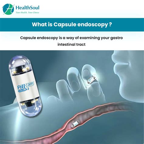 What Is Capsule Endoscopy And Why Is It Used