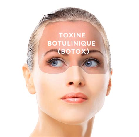 Le Botox Pour Rajeunir Comment ça Doit