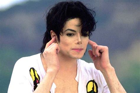 Vitiligo Michael Jacksons Skin Condition Skin Care Geeks