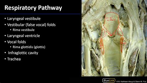 Cavity Of Larynx