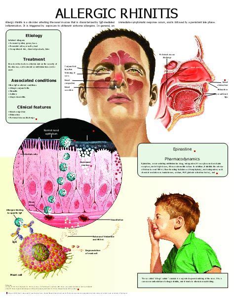 Allergic Rhinitis Pediatric Nursing Allergic Rhinitis Medical Education