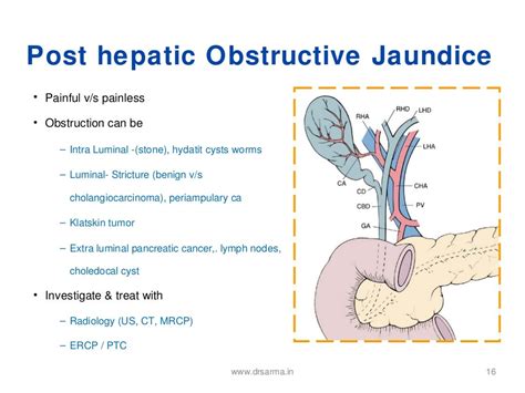 Obstructive Jaundice 1