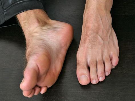 The slender man (also spelled slenderman) is a fictional supernatural character that originated as a creepypasta internet meme created by something awful forum user eric knudsen (also known as victor surge) in 2009. The Best Part of a Man — OMG…these are some of the best looking foot tops... | Male feet ...