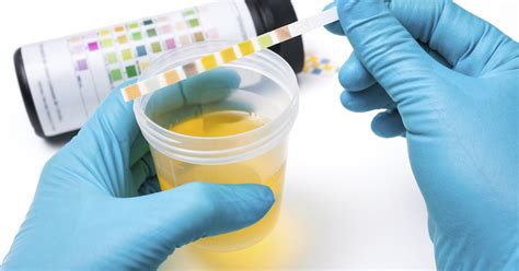 Most people are unaware of what normal ph levels in urine are. What Are the Factors That Influence Urine pH? | LIVESTRONG.COM