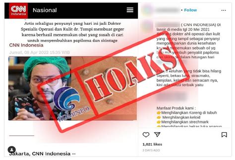 InfoPublik CEK FAKTA Dokter Tompi Temukan Obat Papiloma Dan Skin Tag Yang Susah Dicari