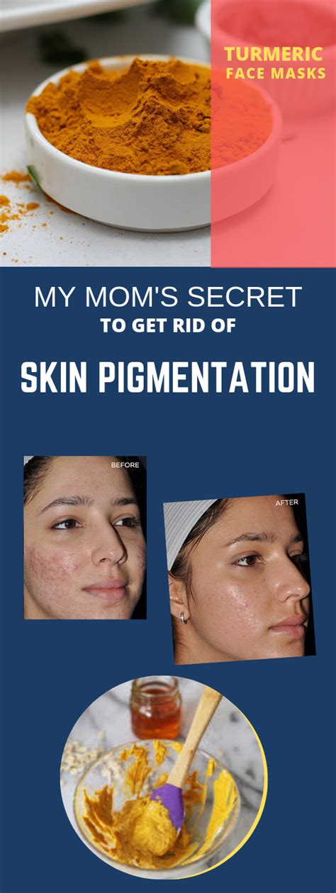 How To Use Turmeric To Get Rid Of Skin Pigmentation Skin