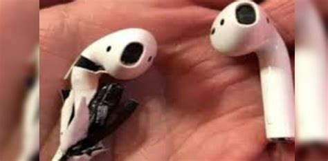 Man Hospitalized After Wireless Earphone Exploded In His Ears