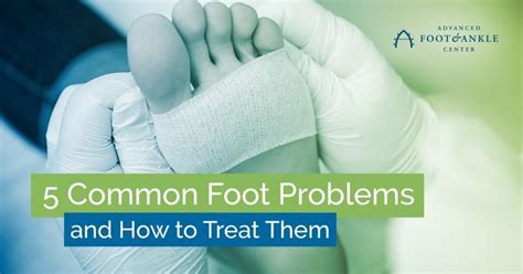 5 Common Foot Problems And How To Treat Them Advanced Foot And Ankle