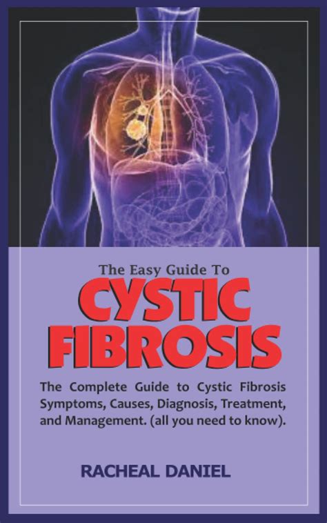 Buy THE EASY GUIDE TO CYSTIC FIBROSIS The Complete Guide To Cystic