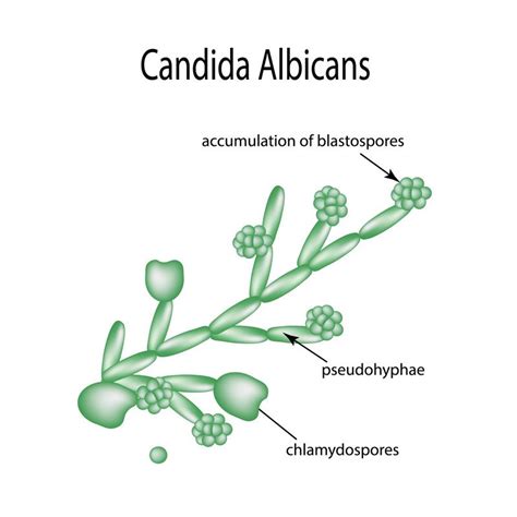 Candida Albicans Type Yeast Causes Candidiasis เวกเตอร์สต็อก ปลอดค่า