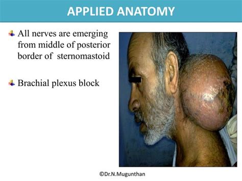 Posterior Triangle Of Neck Powerpoint Lecture Notes By Drnmugunthan