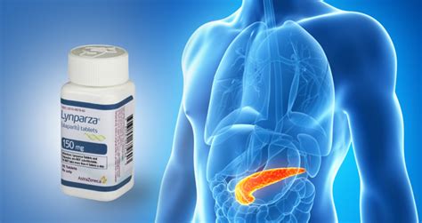 Последние твиты от astrazeneca (@astrazeneca). AstraZeneca and Merck Get FDA Nod for Lynparza for ...