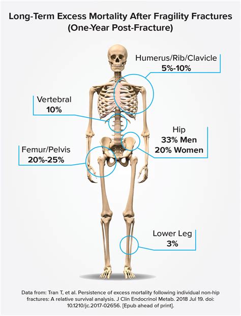 Osteoporosis Medical Terminology Breakdown