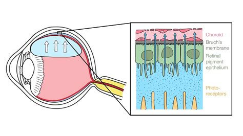 Mechanism Of Retinal Reattachment Following Pneumatic Retinopexy Youtube