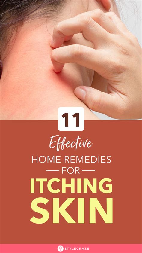 18 Effective Home Remedies To Get Rid Of Itching Skin Dry Itchy Skin