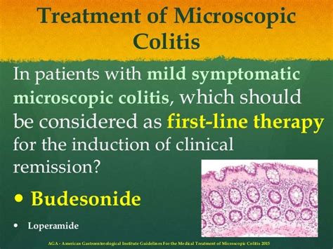 Medical Treatment Of Microscopic Colitis