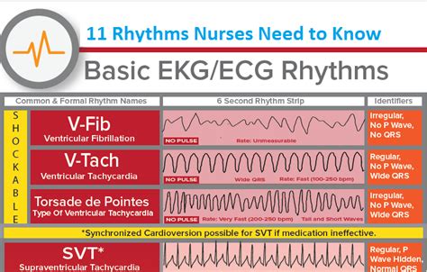 Basic Ecgekg Rhythms Nclex Cheat Sheet Medical Estudy