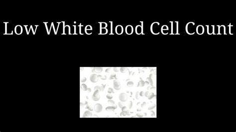 Low Wbc Causes How To Increase White Blood Cell Count Youtube
