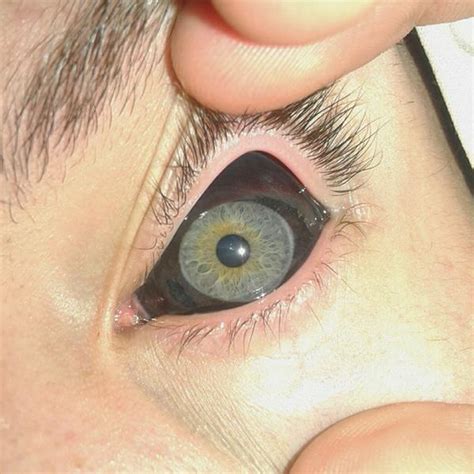 23 Eyeball Tattoos For People Who Love Extreme Body Mods