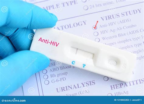 Hiv Negative Test Result Stock Image Image Of Antigen 121802283