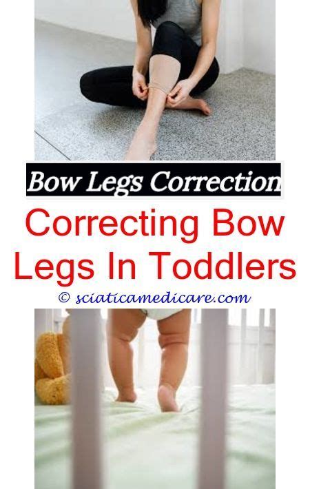 Bow Leg Surgery For Adults How To Correct Knock Knees Bow Legged