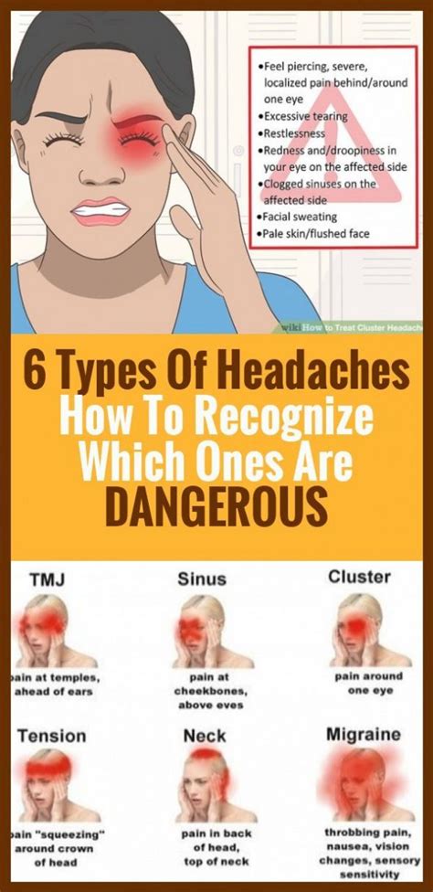 6 Types Of Headaches Which Ones Are Dangerous To Recognize In 2020