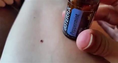 How To Remove Ticks With Peppermint Oil Tick Removal Pepermint