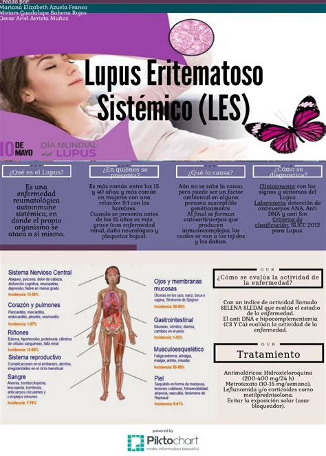 DivulgaciÓn CientÍfica Ug Lupus Eritematoso Sistémico