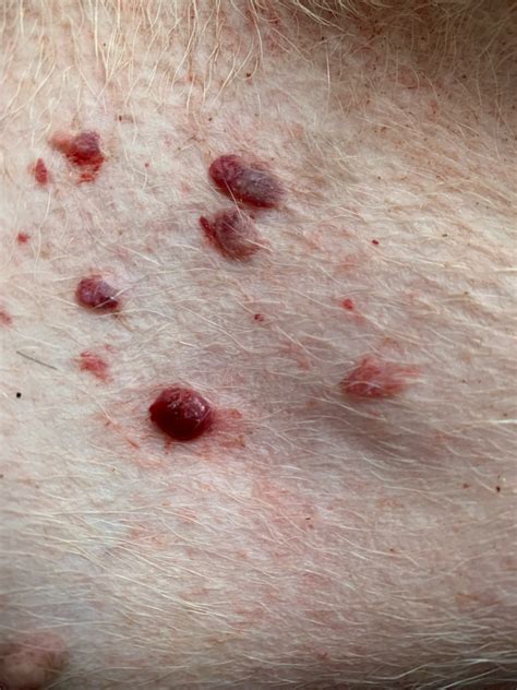 Blood Blisters On Dog Stomach