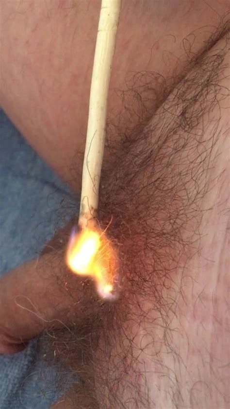 Burning Pubic Hair Gay Bdsm Hd Porn Video A2 Xhamster