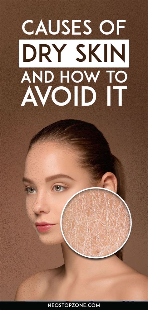Causes Of Dry Skin On Face Body And How To Avoid It And Its Remedies