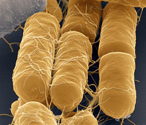 Bacillus Cereus Bacteria Sem Photograph By Meckesottawa Fine Art America