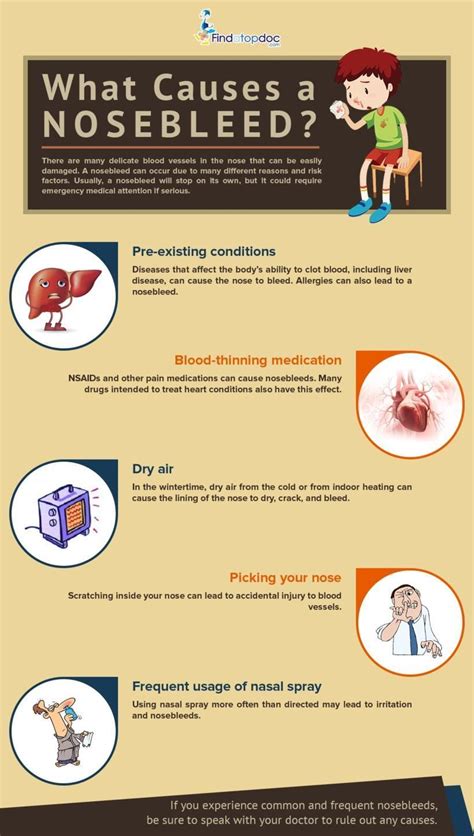 What Causes Nosebleeds Infographic
