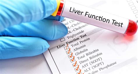 Liver Function Tests Understanding Your Blood Test Results Dr Sandra Cabot MD